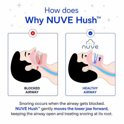 NUVE Hush™ — Anti-Snoring Mouthpiece
