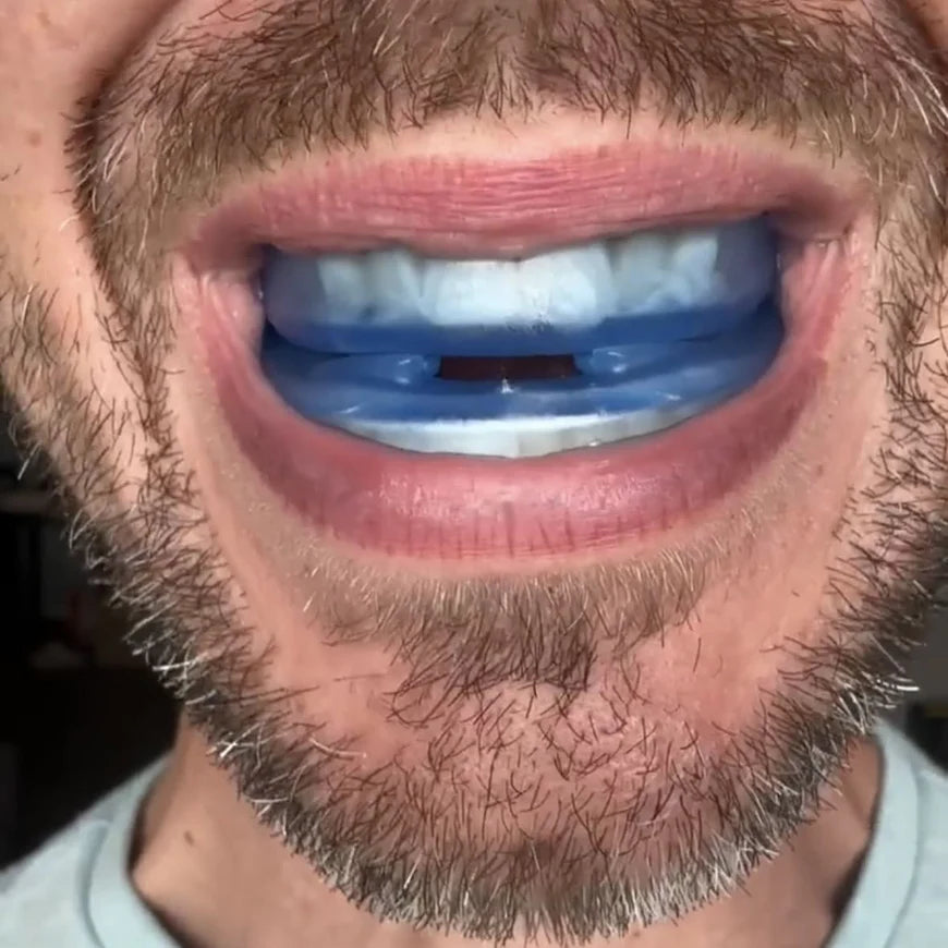 NUVE Hush™ — Anti-Snoring Mouthpiece