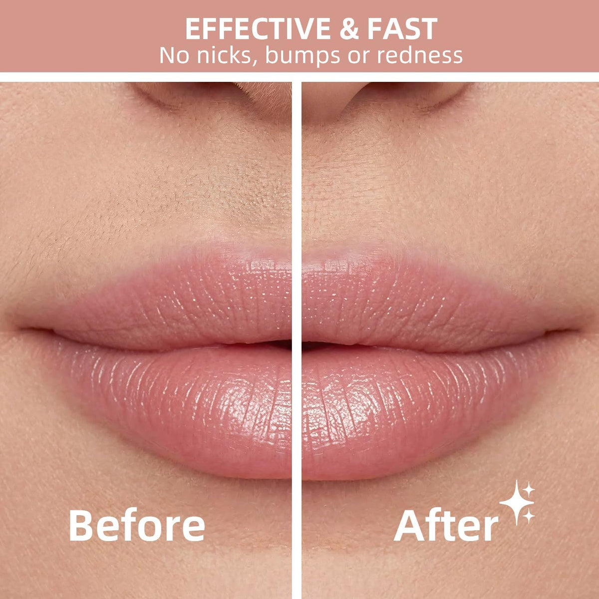 NUVE SmoothTouch