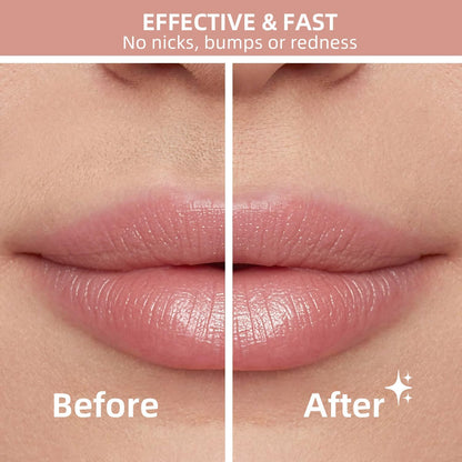 NUVE SmoothTouch