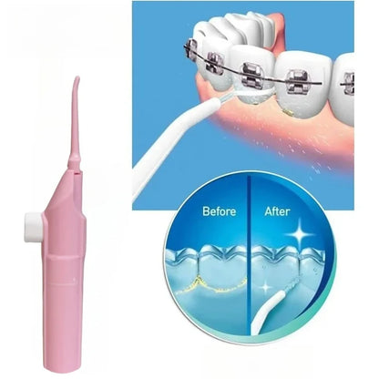 Nuve High Pressure Portable Dental Water Flosser