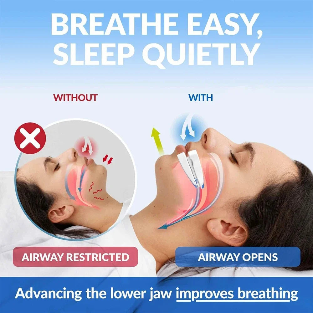 Anti Snore Mouthpiece,Adjustable Sleeping Mouth Guard,Stop Snoring Device for Night Time Teeth Protection and Bruxism